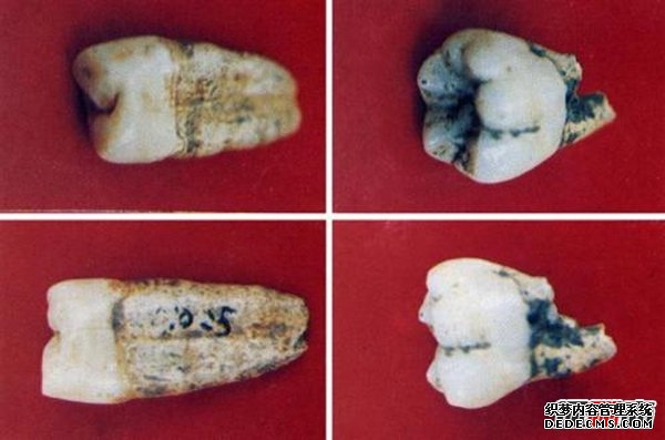 人类未公开的十大史前文明,1.3万年前就有牙医存在了